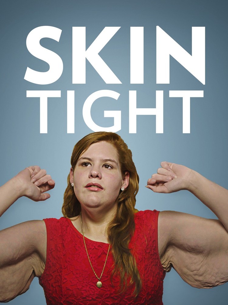 Skin Tight Season Two Of Post Weight Loss Series Coming